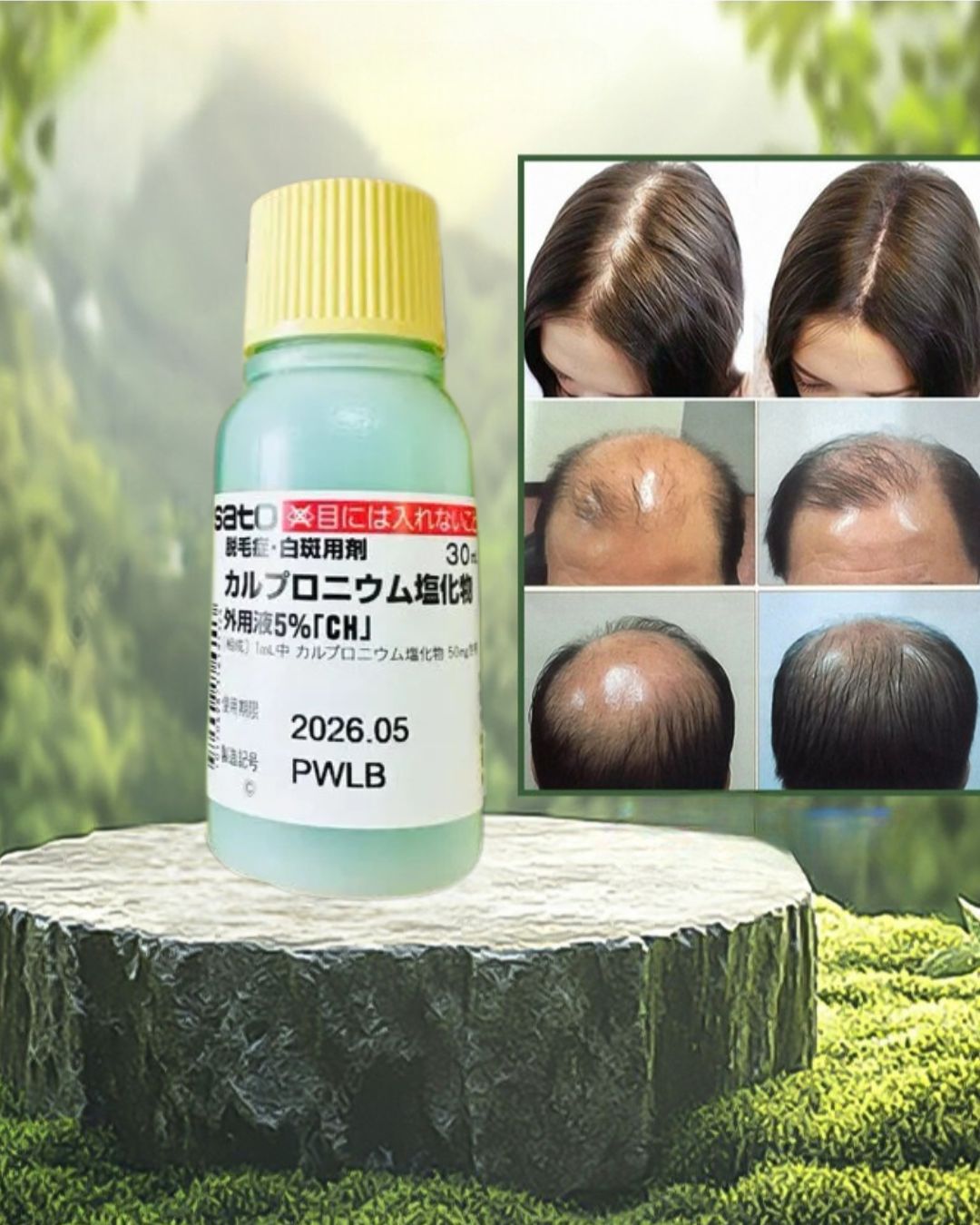 Sato Carpronium Chloride Solution 5% 30ml Hair Fall Tonic Made In Japan 30ml