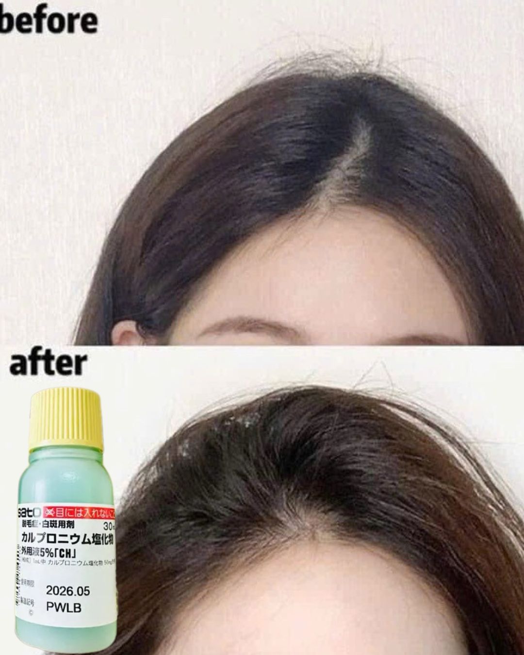 Sato Carpronium Chloride Solution 5% 30ml Hair Fall Tonic Made In Japan 30ml