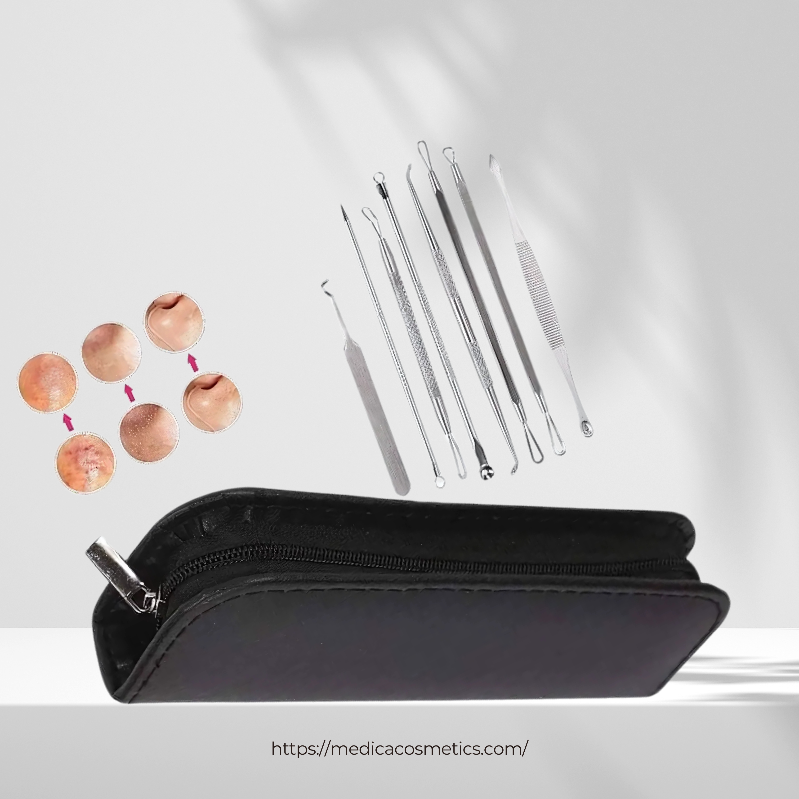 Blackhead Remover Kit
