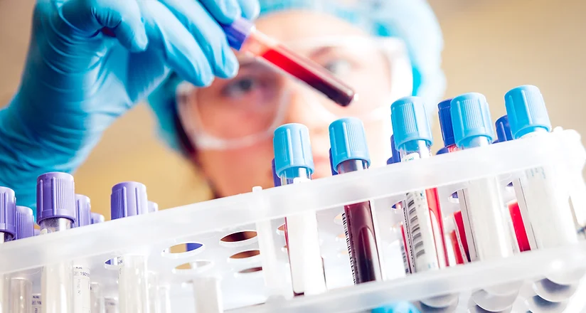 Menopause Hormones Profile