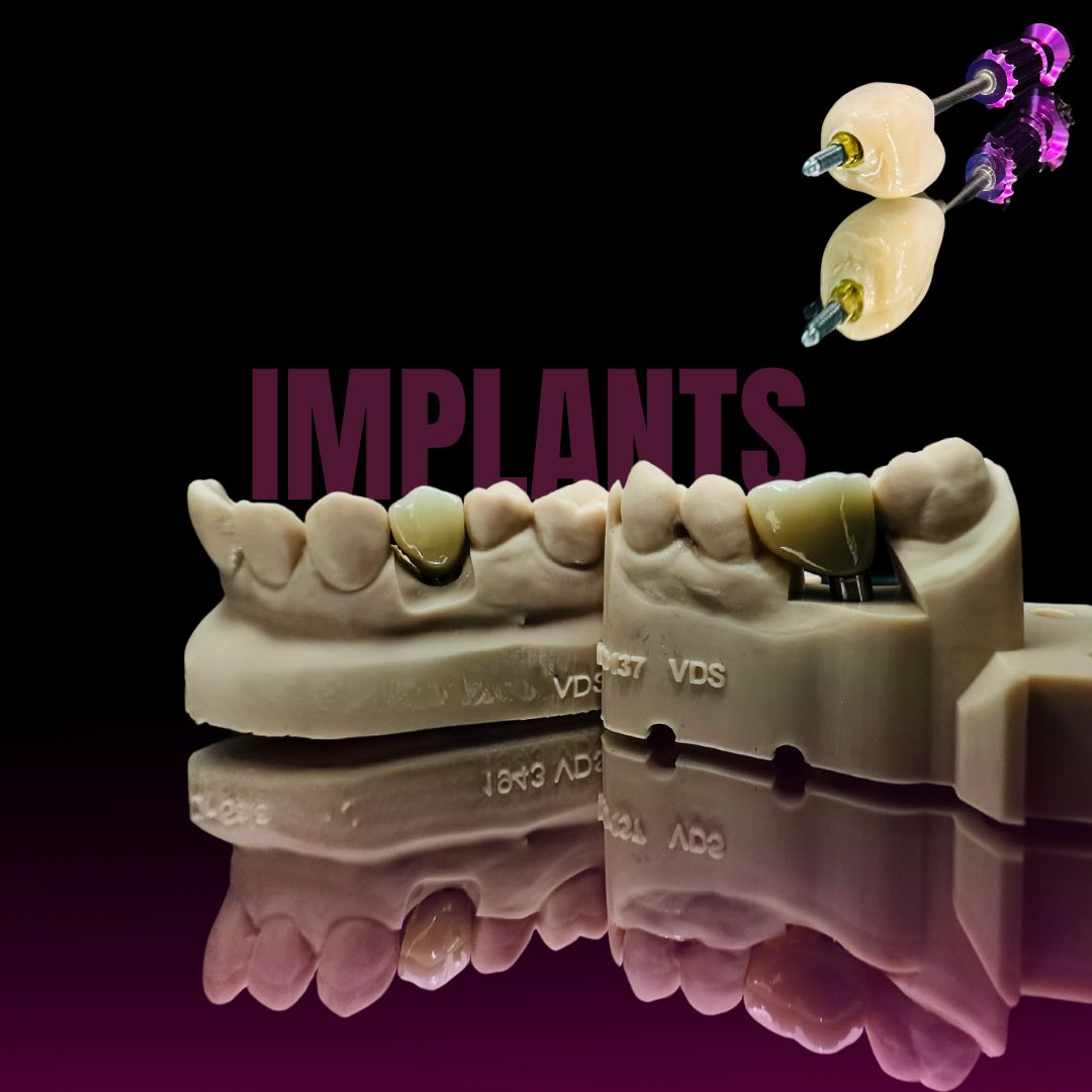 Implants