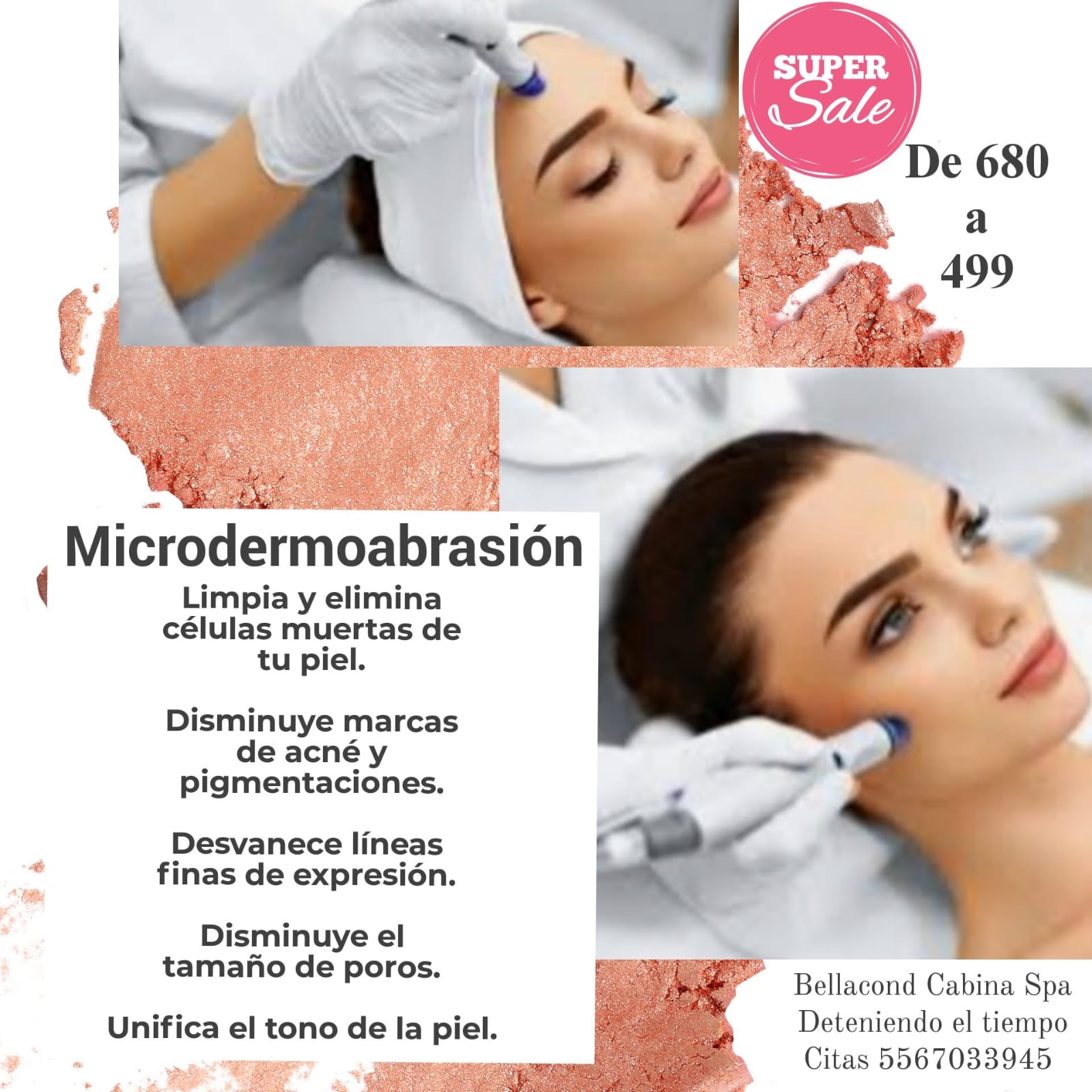 Microdermoabrasión