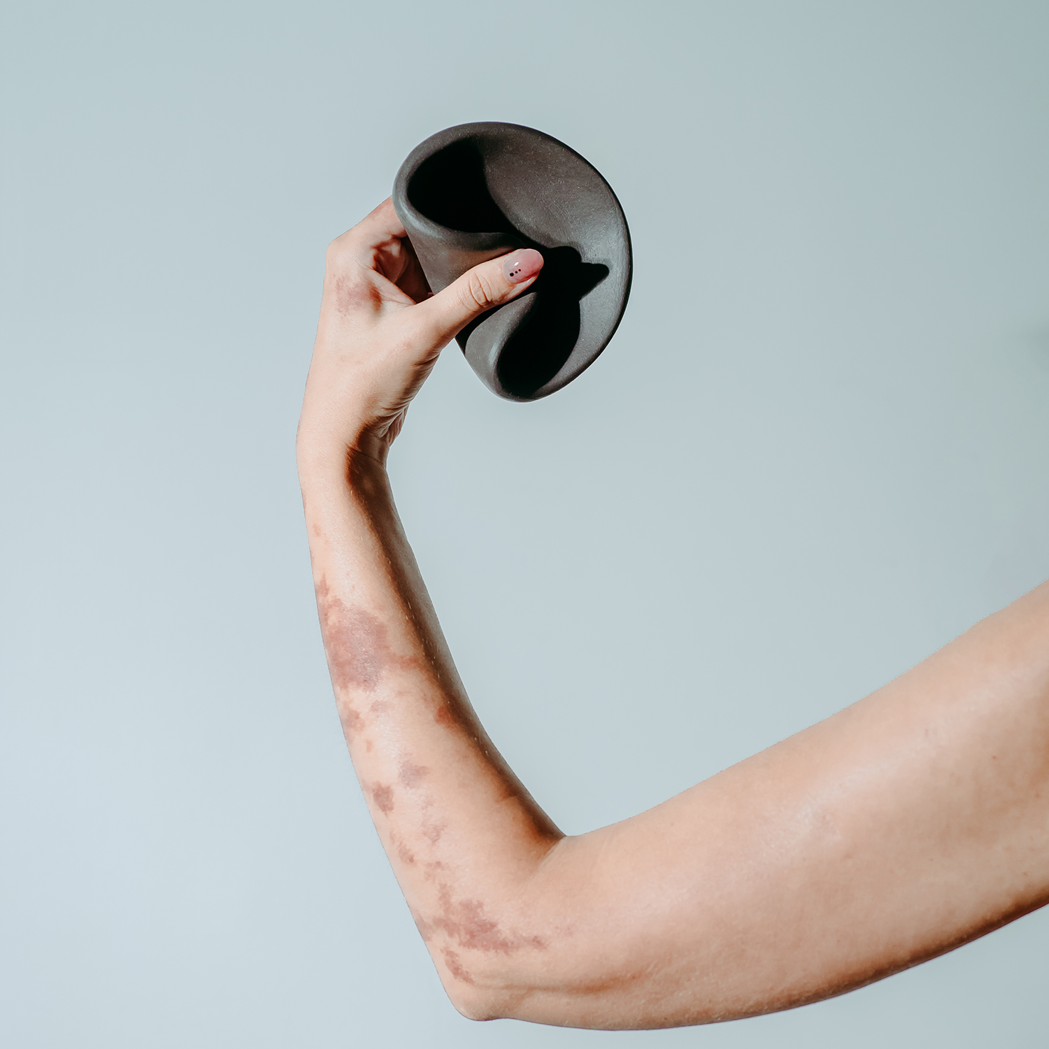 Smilkalinė MAŽOJI FORMA