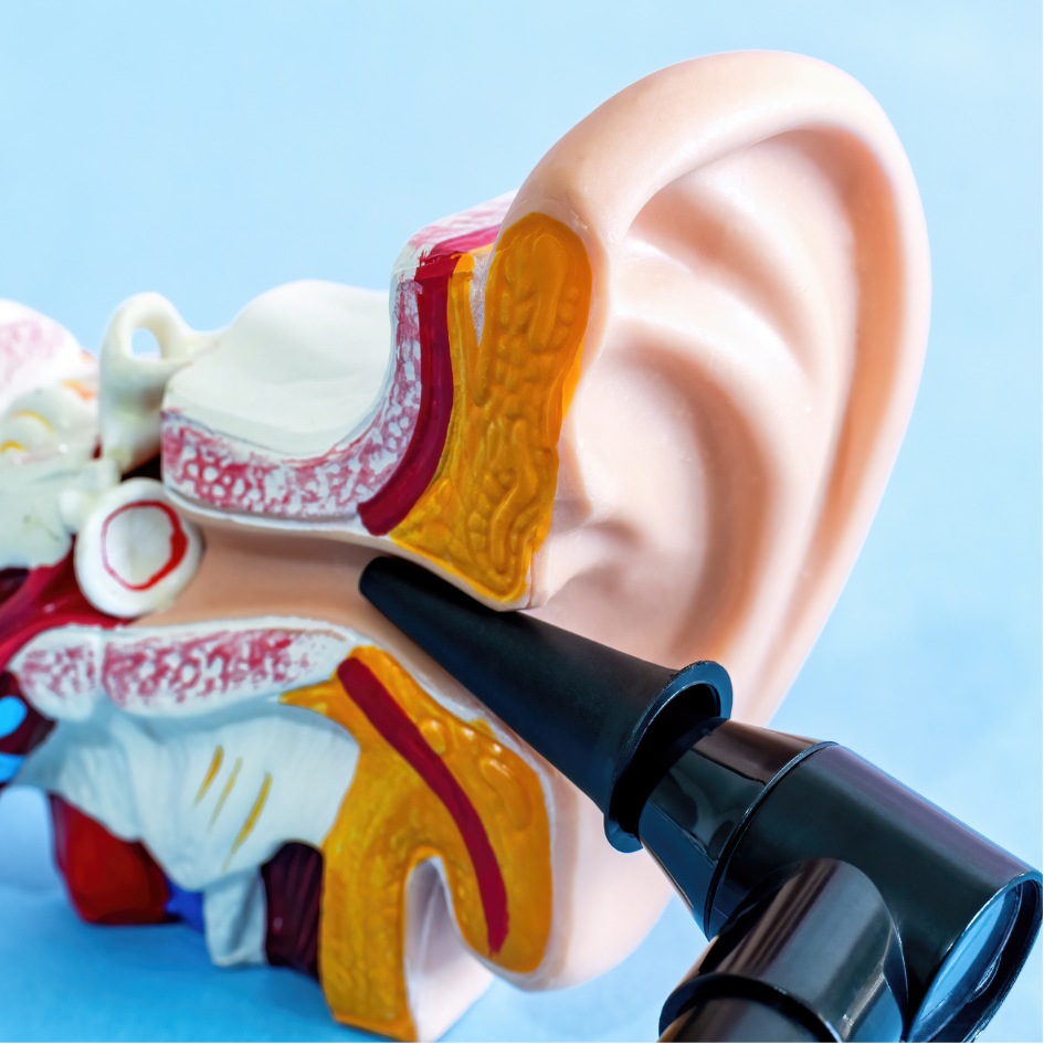 Custom ear impressions