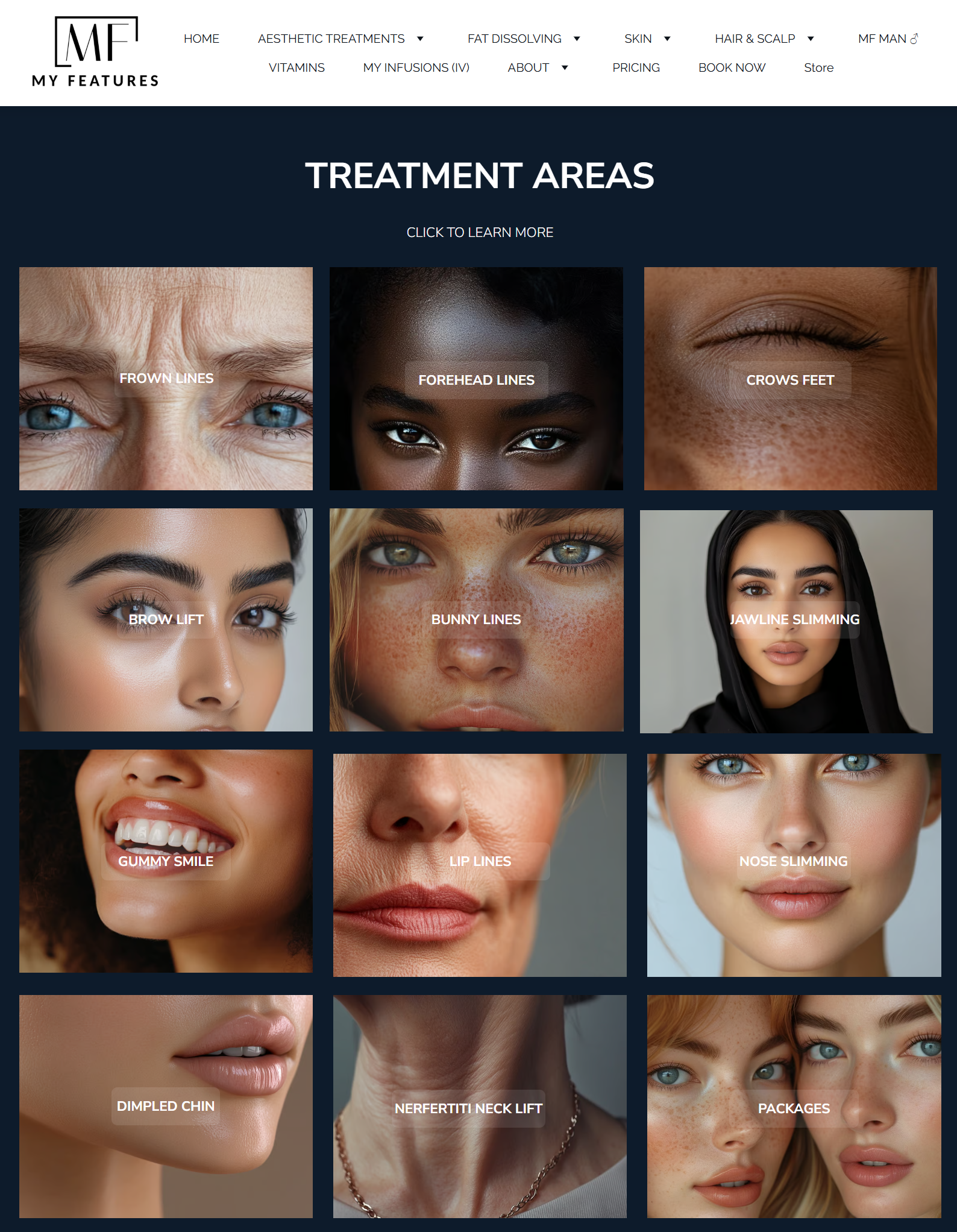 Frown Lines  (Botulinum)