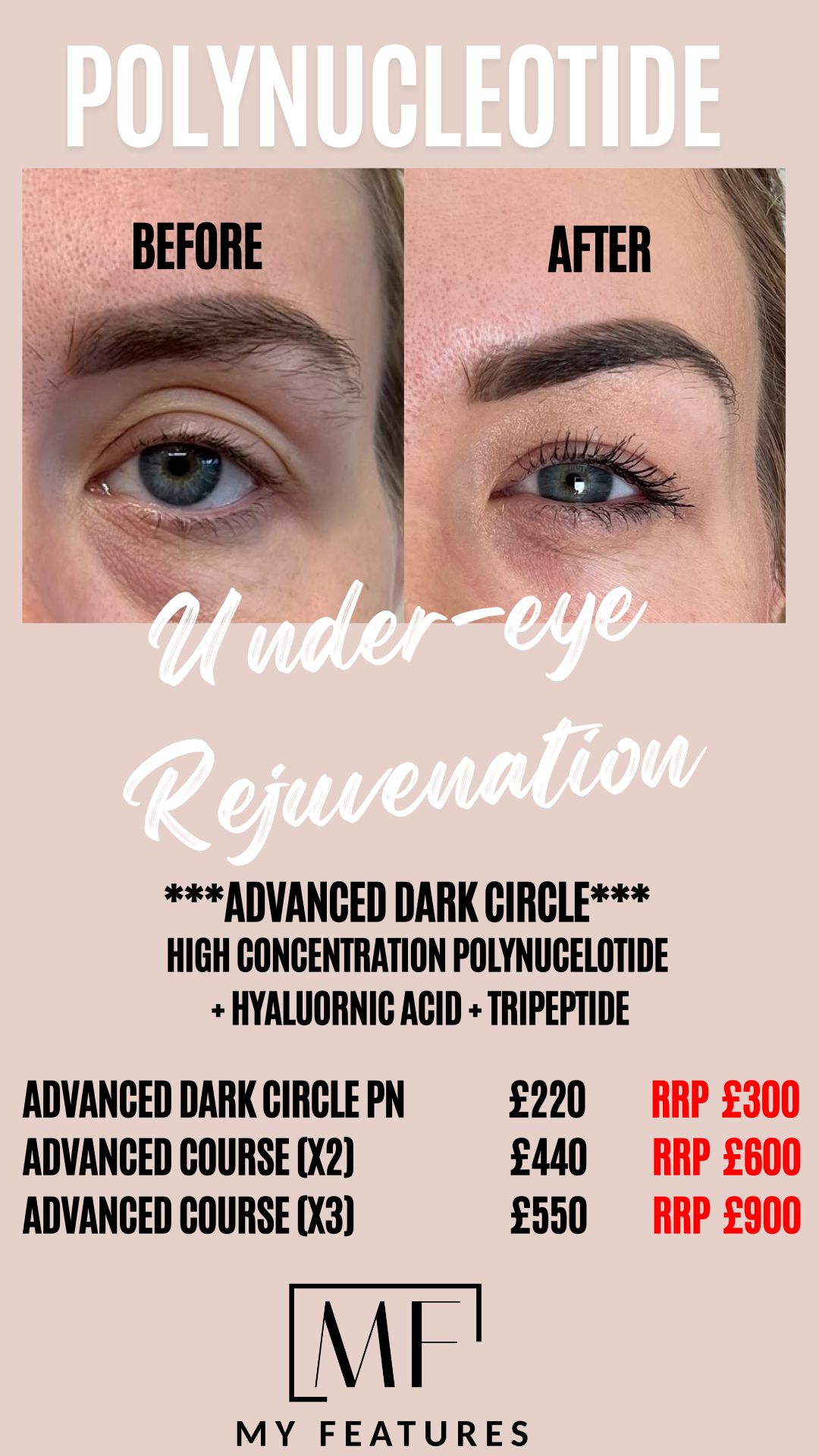 ADVANCED DARK CIRCLE Pn + Ha (COURSE X3)