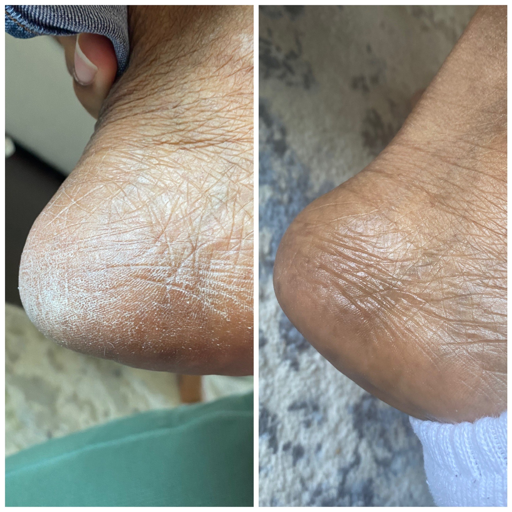 All Natural Foot Balms
