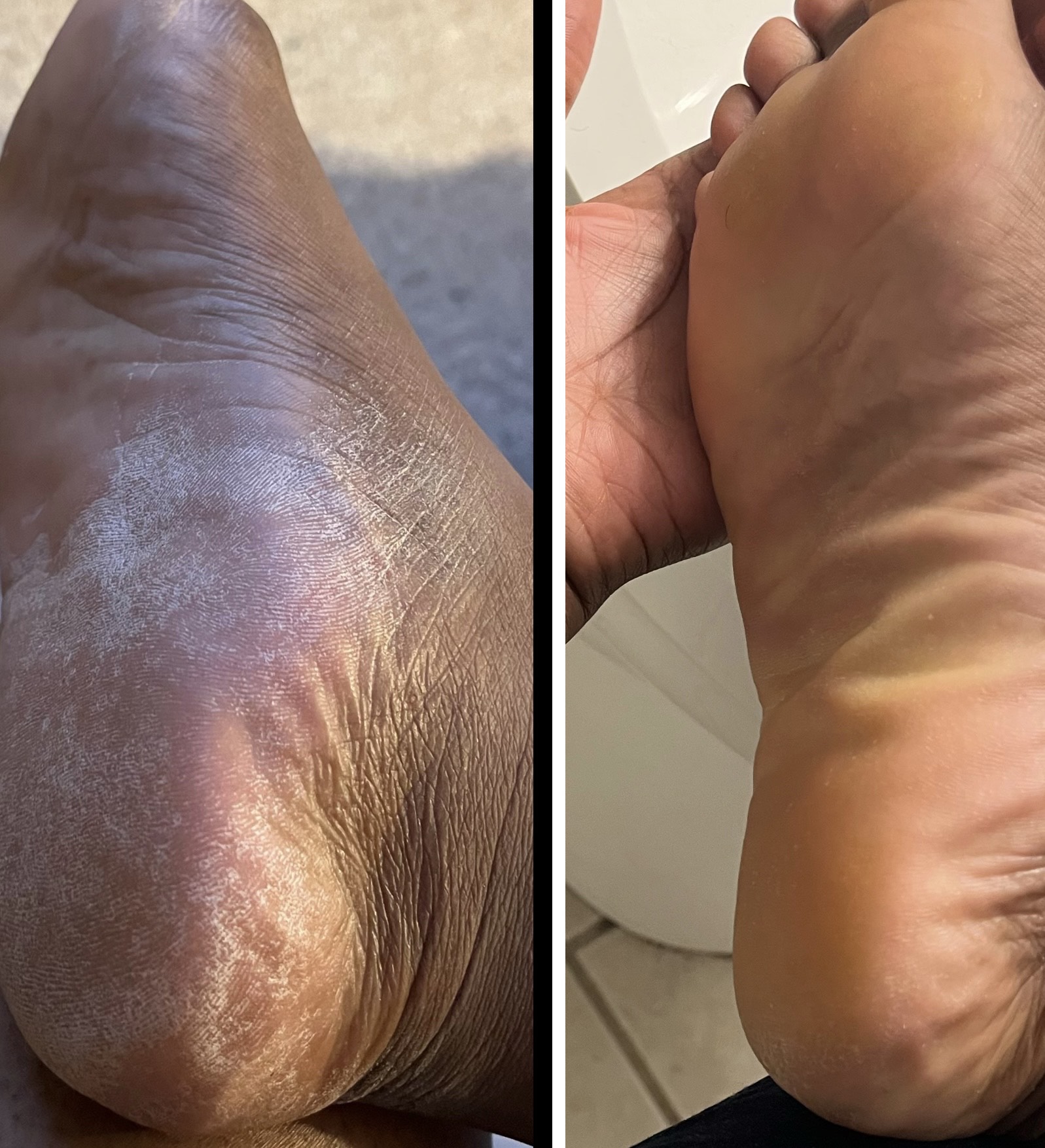 All Natural Foot Balms