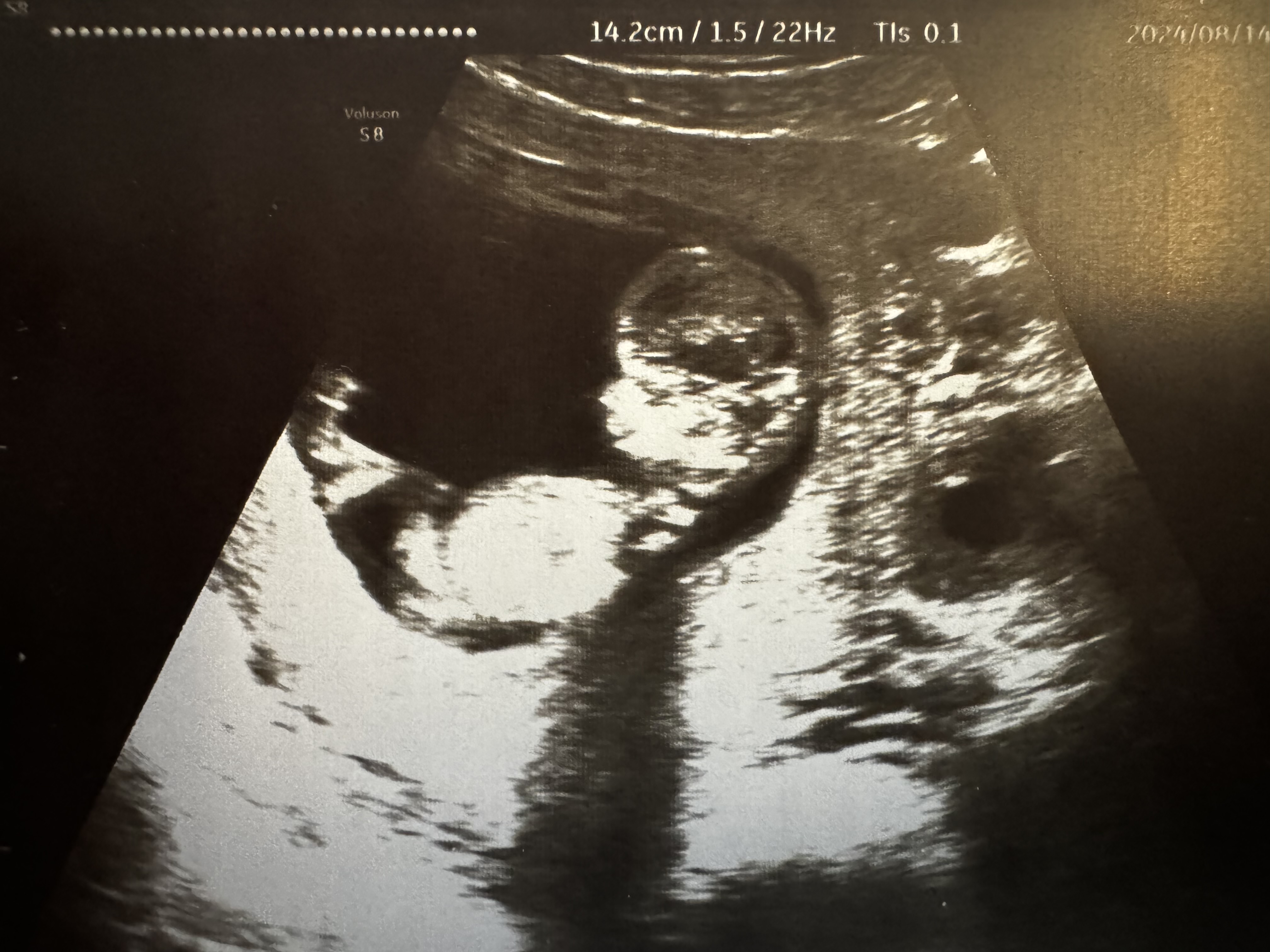 Individualūs mokymai mamoms