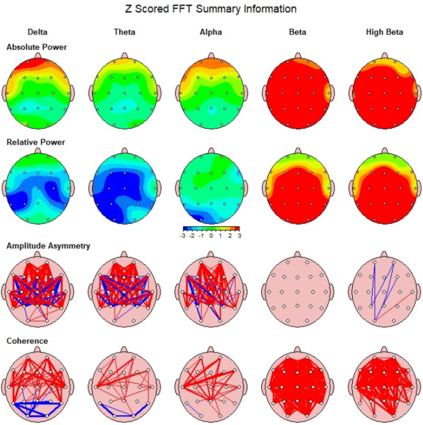 Funkcinis tyrimas su qEEG (Smegenų žemėlapis) 