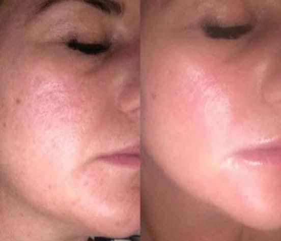 Soin de visage anti imperfections 