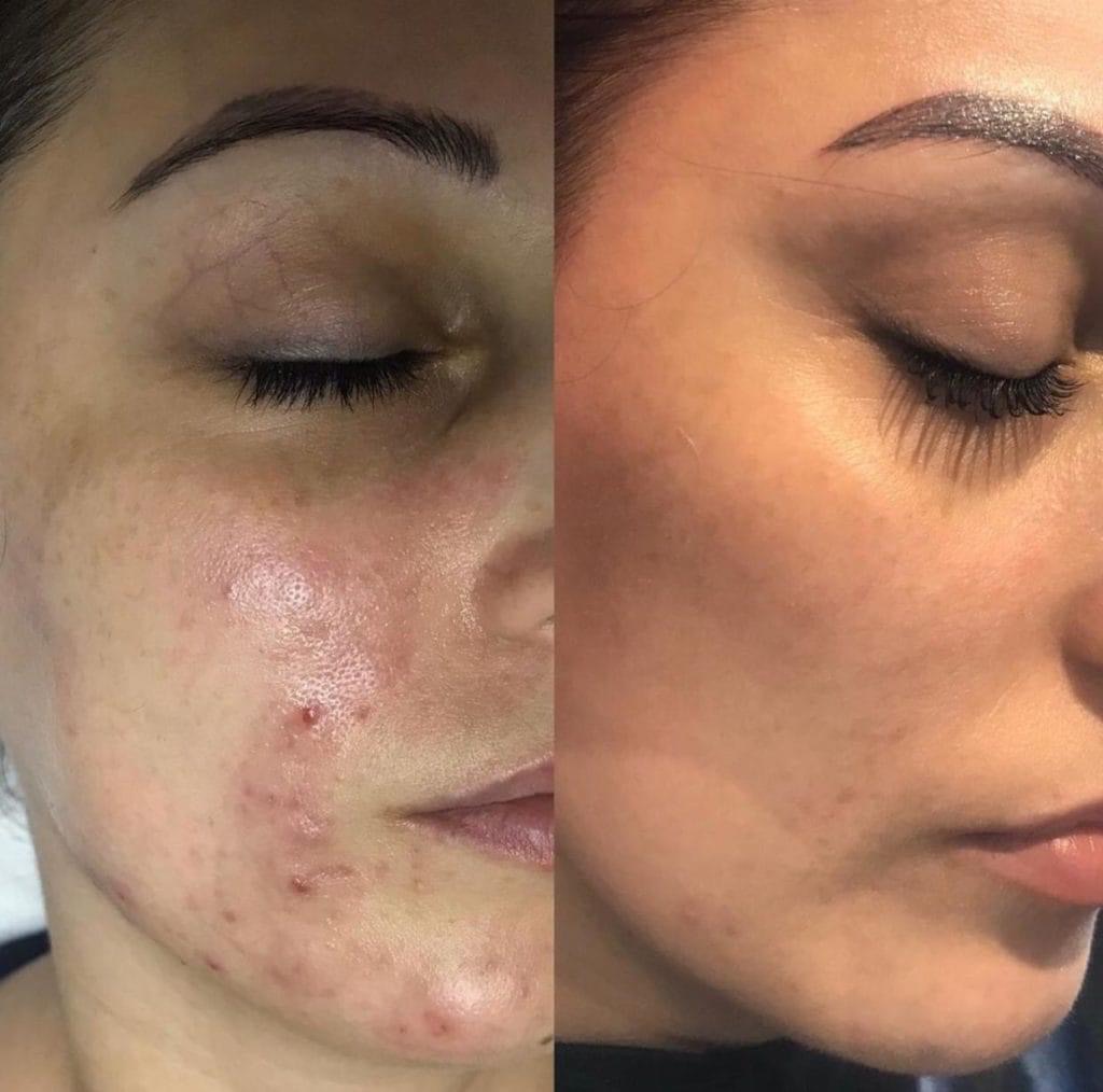 Soin de visage anti imperfections 