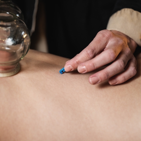 Puodelių terapijos rinkinys inSPORTline Sebsahar