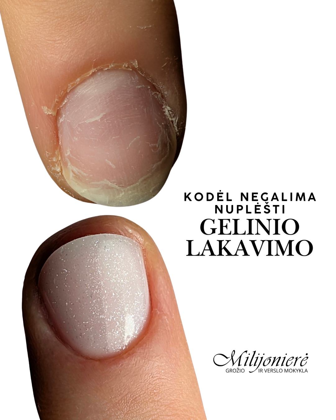 Kodėl negalima nuplėšti gelinio lakavimo