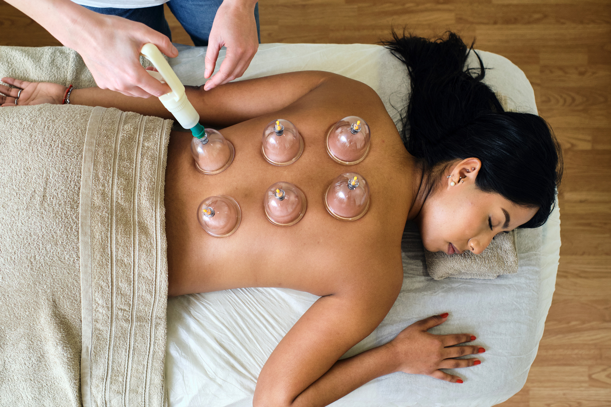 Vacuum Cupping