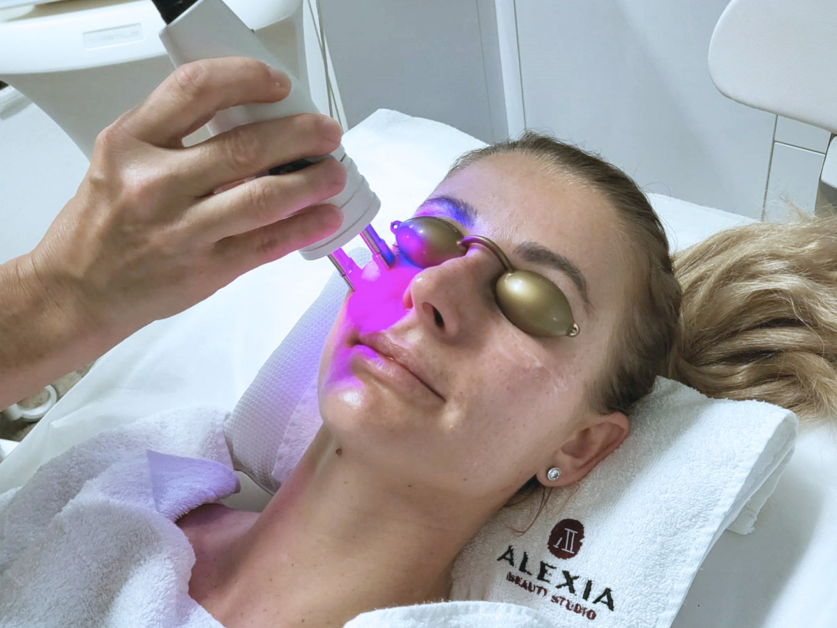 Laserová výplň vrások