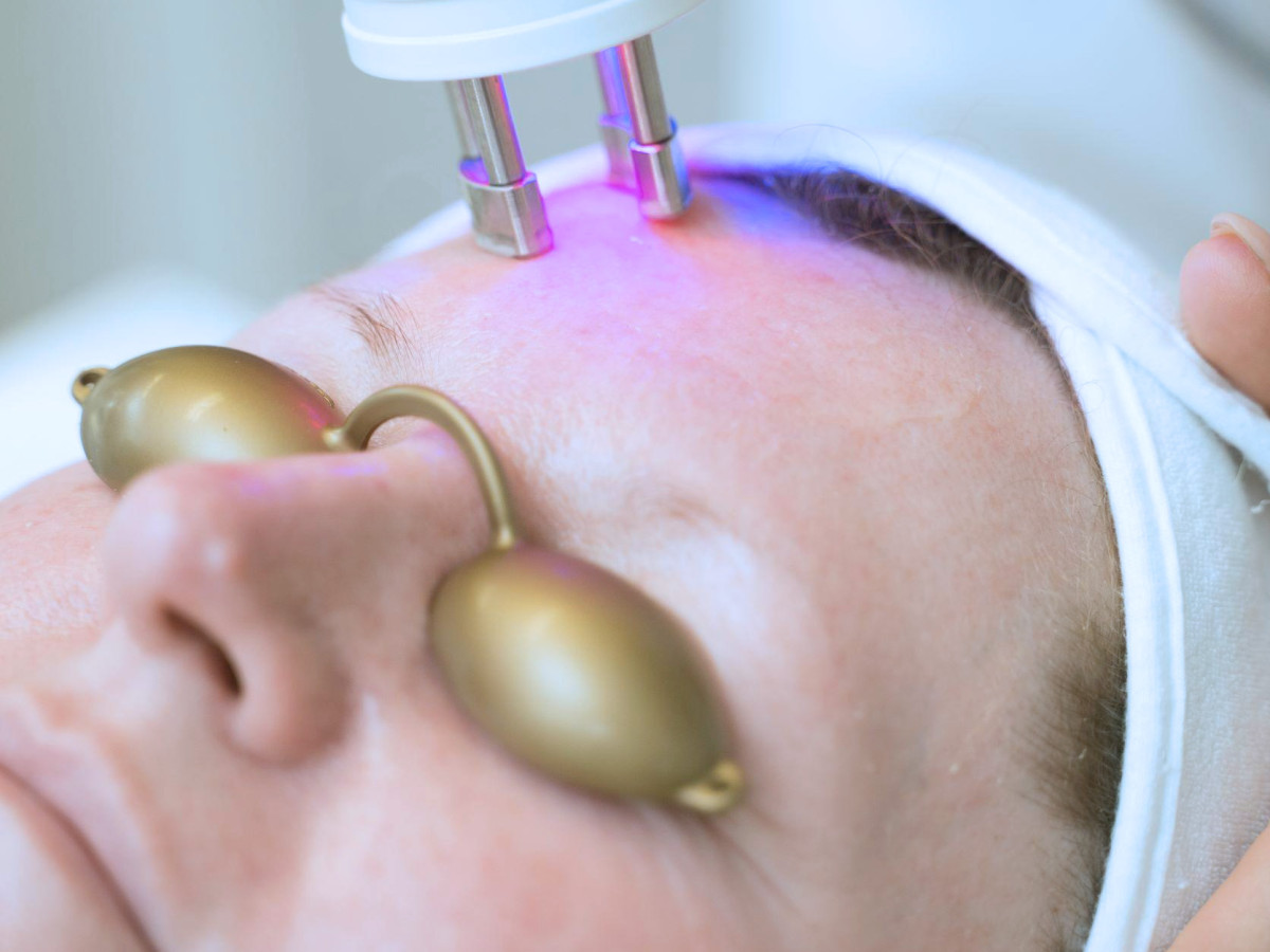 Revitalizácia pokožky Laserom 3.0 s BioFiller gélom 