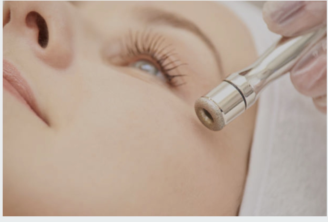 💎 The Diamond-Tip Microdermabrasion: Face & Neck