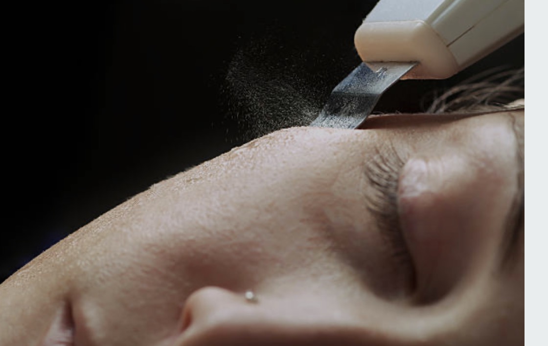 ⚡Ultrasonic Facial - Clarity Infusion