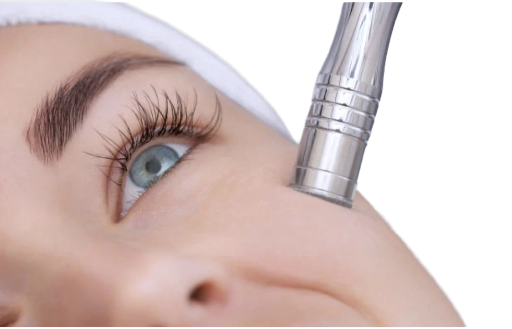 💎 The Diamond-Tip Microdermabrasion: Face Only