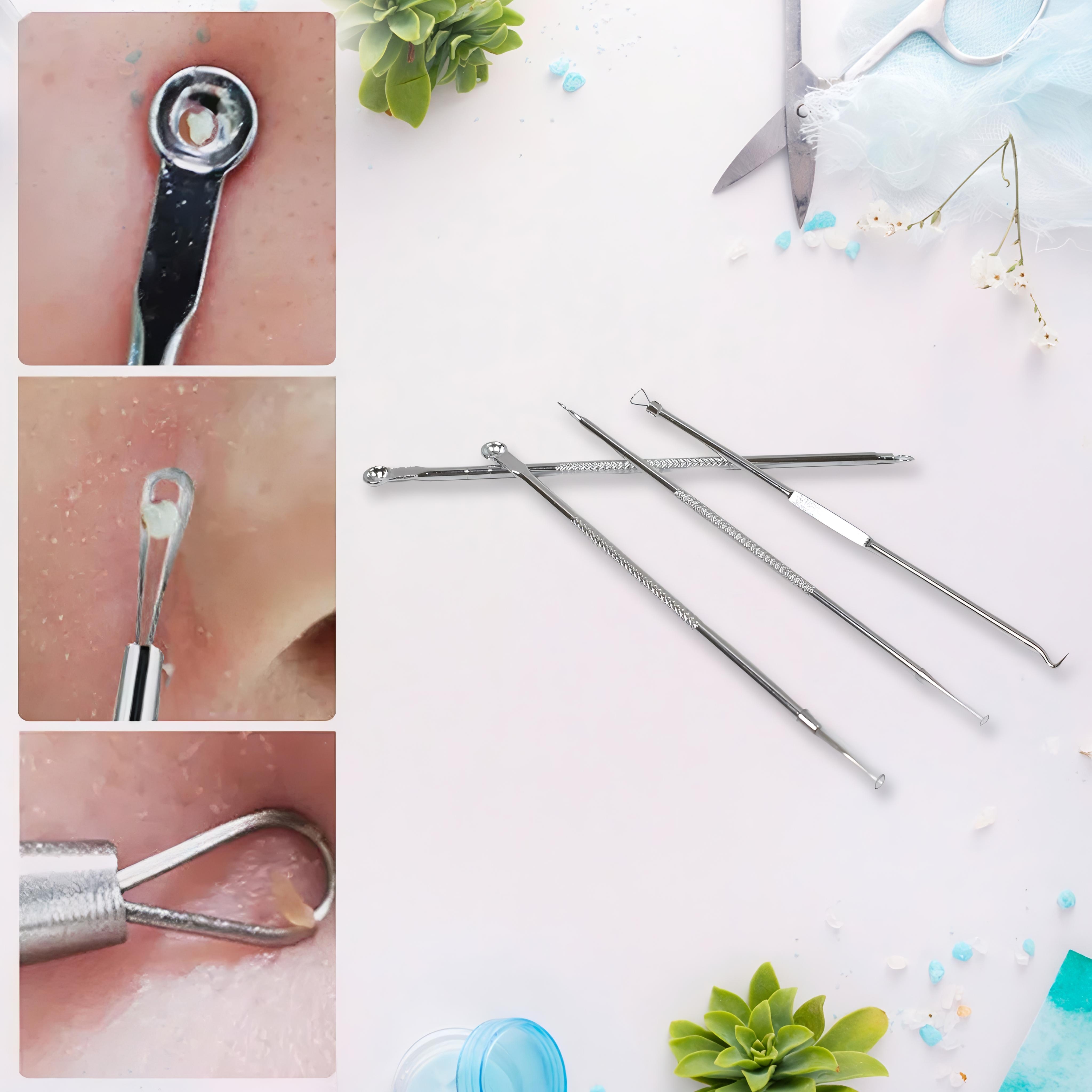 Blackhead Removal Tools Set