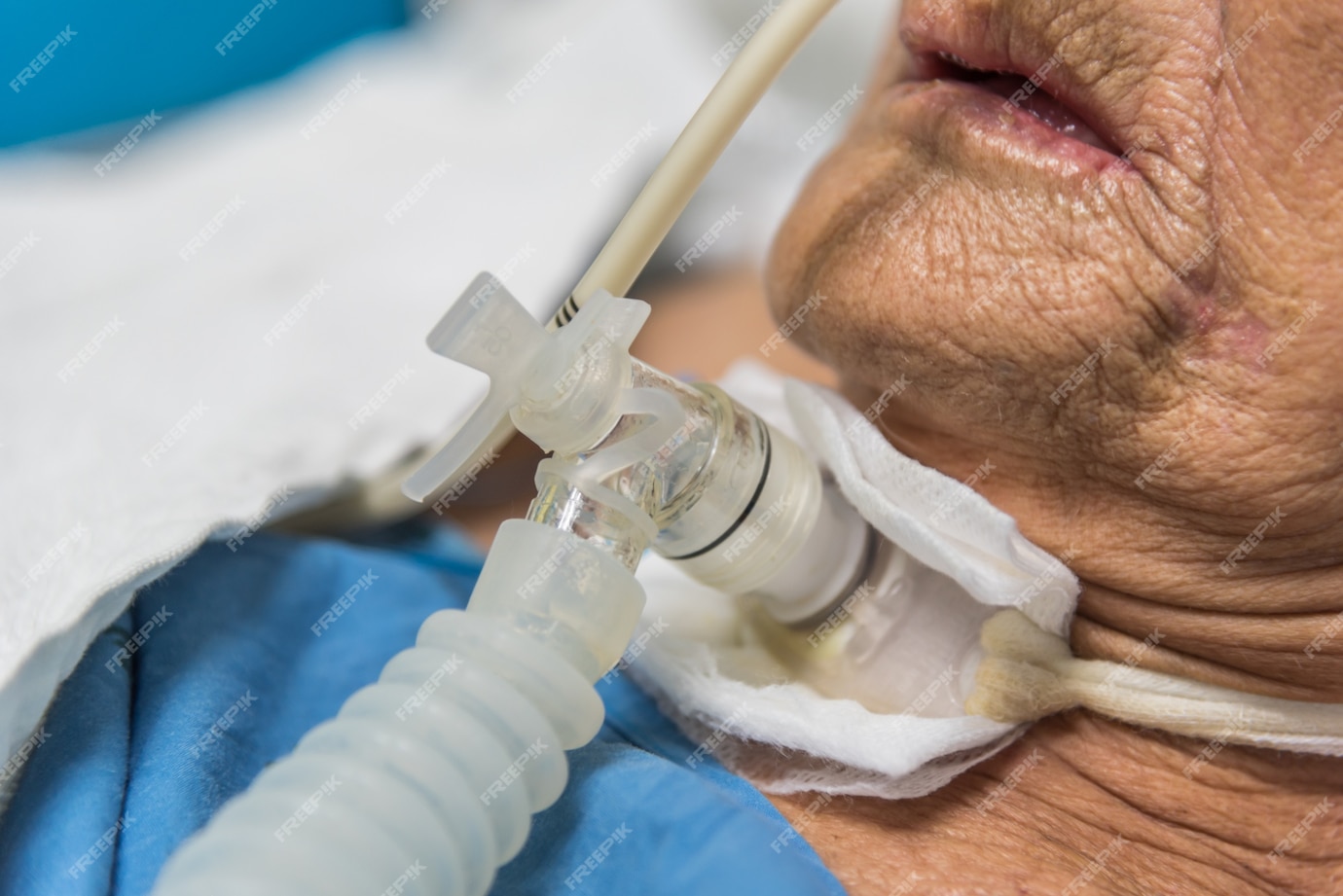 Nursing Home Service