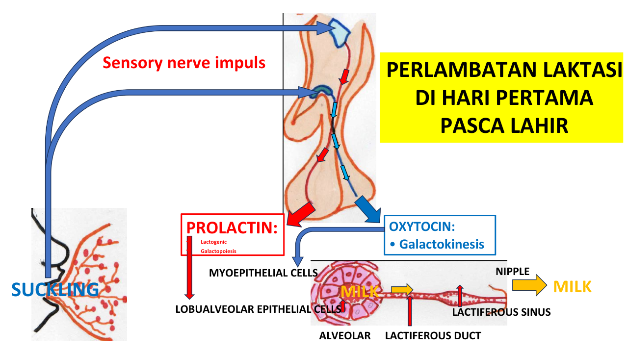 Perlambatan Laktasi di Hari Pertama Pasca Lahir (Video)