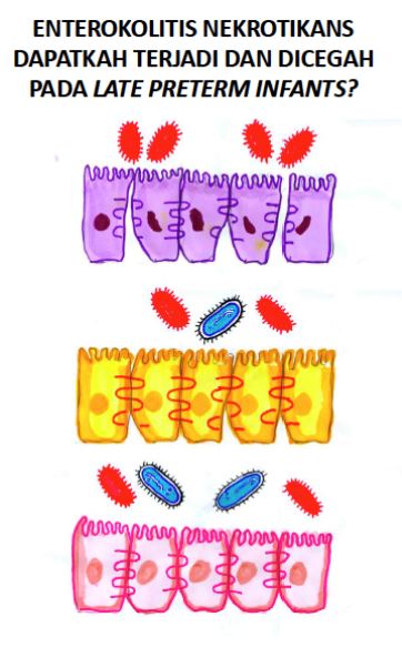 Materi Coaching Topik 3: Enteroklitis Nekrotikans (NON-SKP)