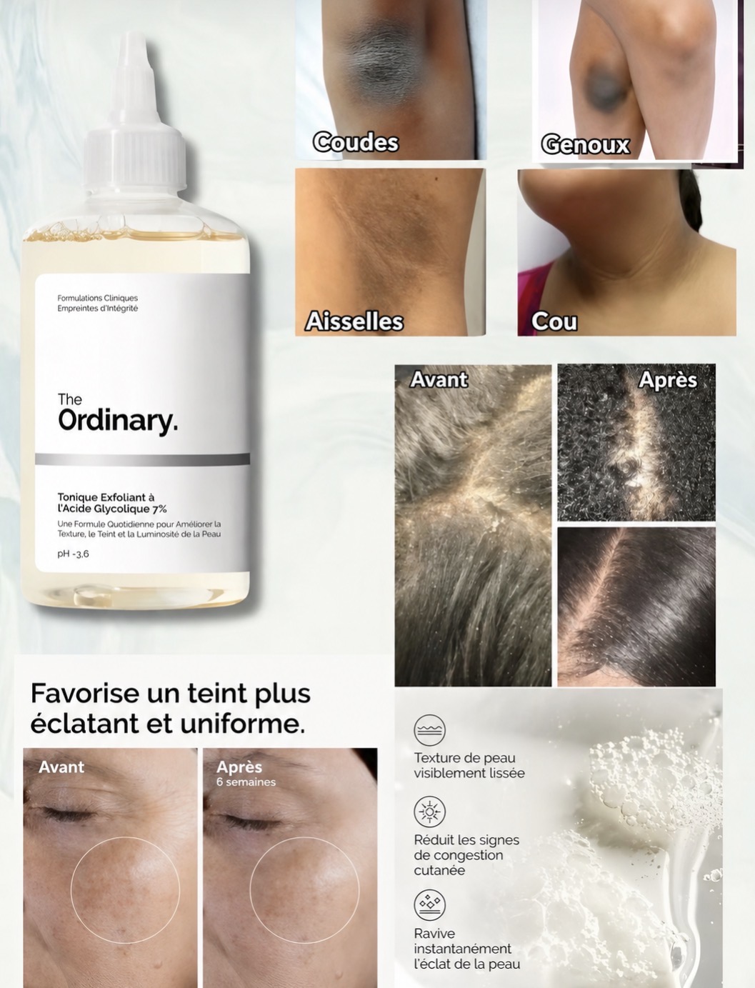 The Ordinary Glycolic Acid 7% Tonique Exfoliant 100 ml