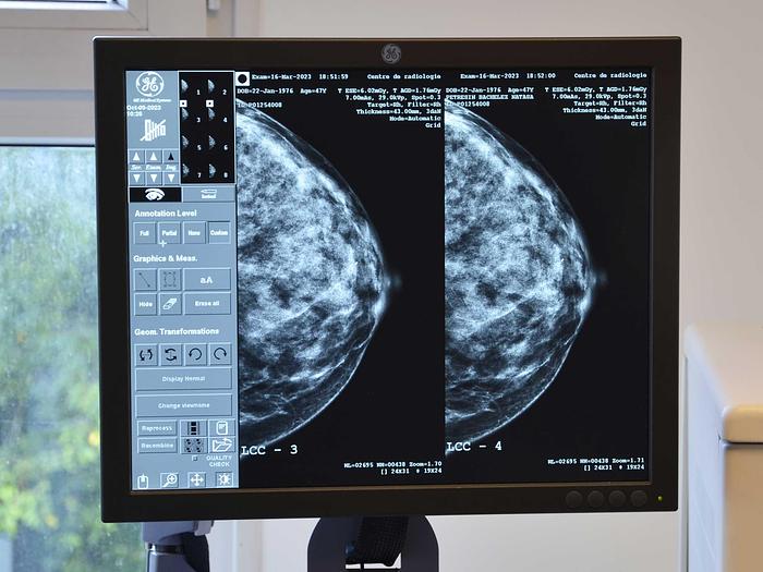 mammographe 3D GE Senoclaire de General Electric