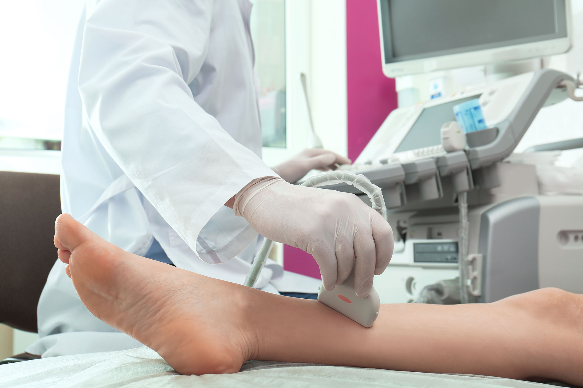 Upper & Lower Extremity Arterial Ultrasound – Leg & Arm Arteries