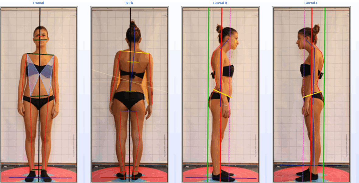 Valutazione posturale completa di test e valutazione della deambulazione