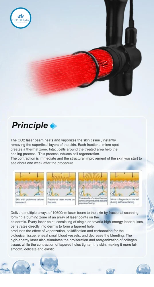 Fractional Laser CO2