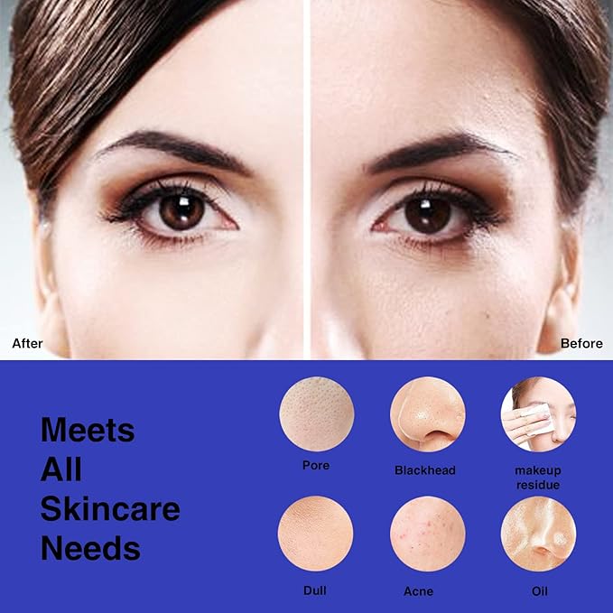 NågraCoola CLIE Facial Cleansing Brush