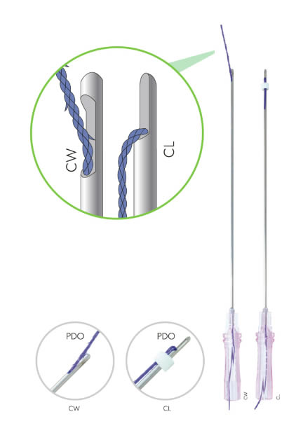 Hilos PDO | Espiculados