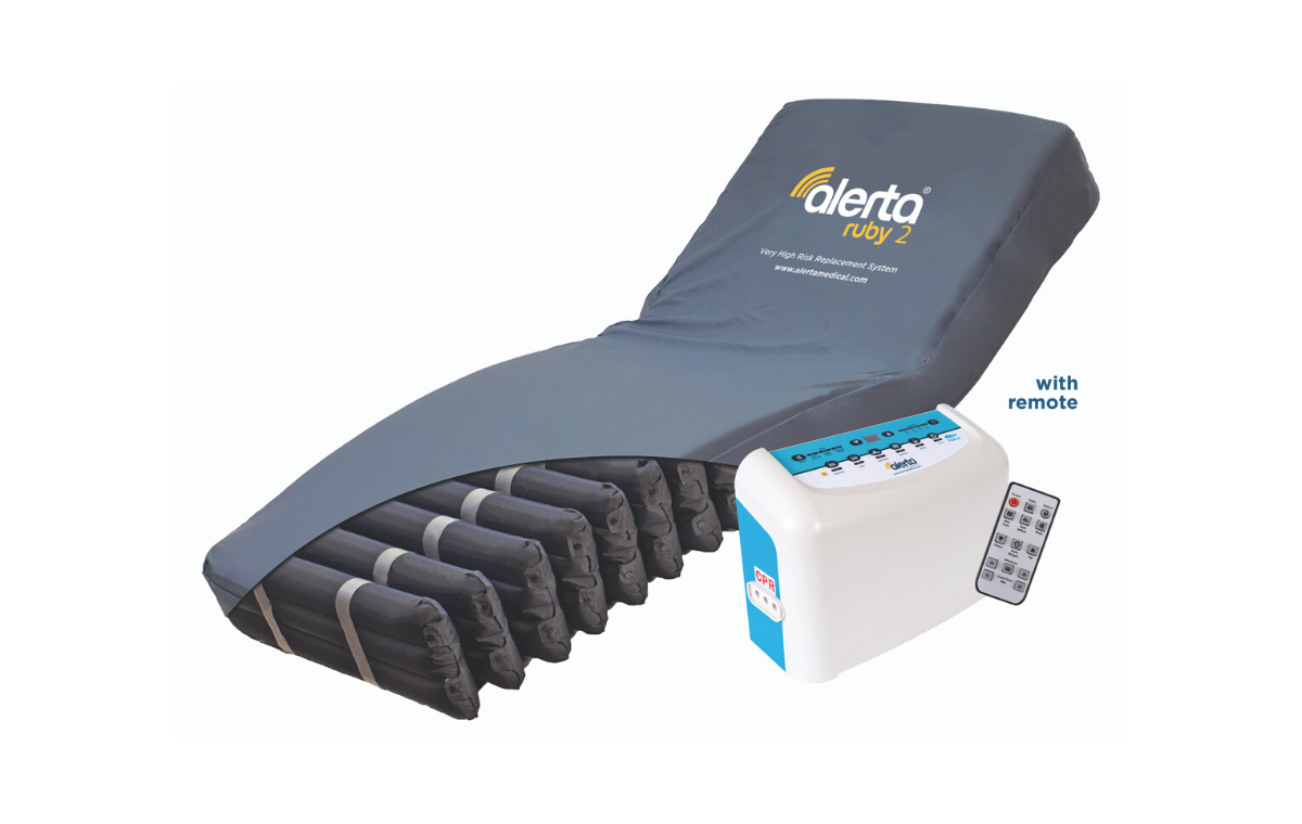 Alerta Ruby 2 Replacement System - ALT-9008