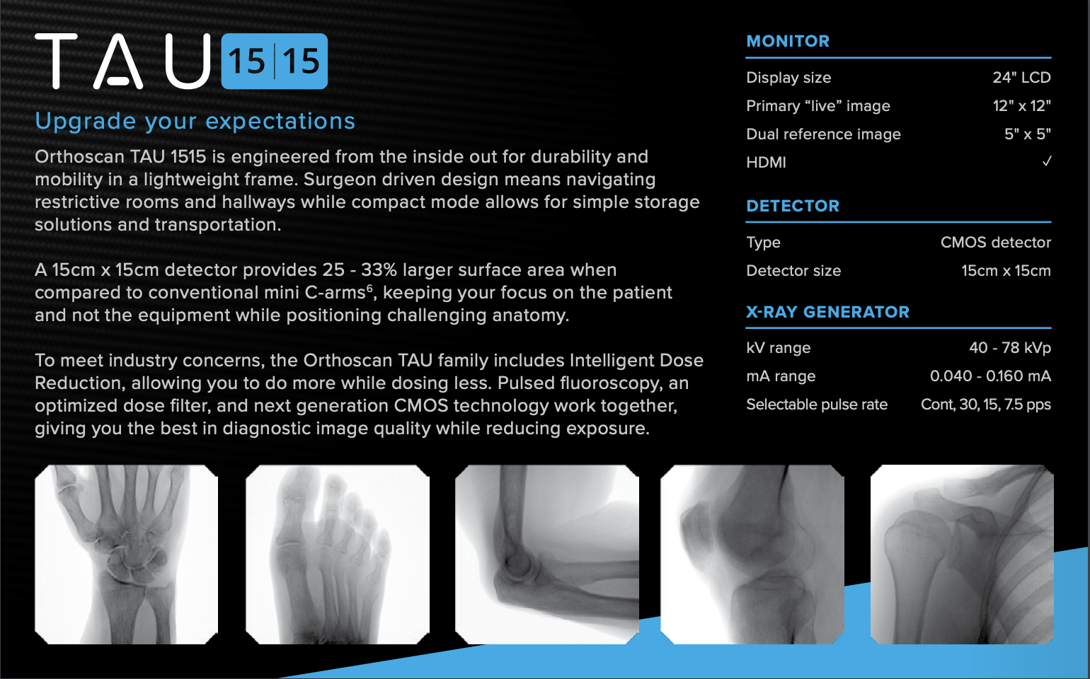Orthoscan - MINI C-ARM 15 | 15