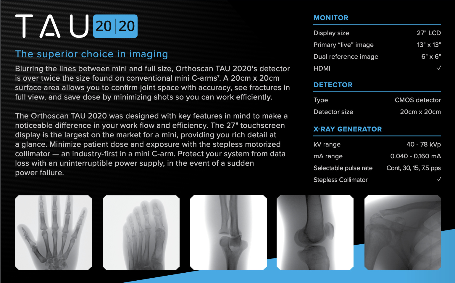 Orthoscan - MINI C-ARM 20 | 20