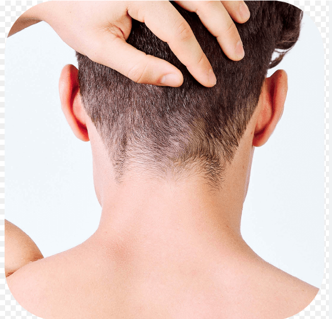 Depilación de Hombres Nuca con cera