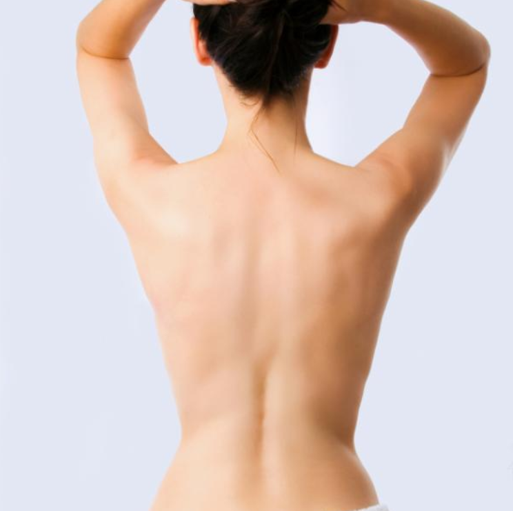 Depilación de Mujeres Espalda