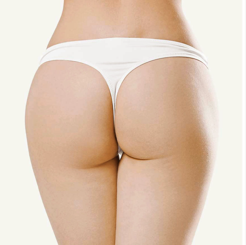 Depilación de Mujeres Inter glúteo