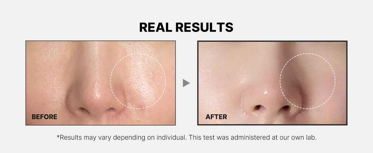 Medicube Zero Pore Pad mild (70pcs)