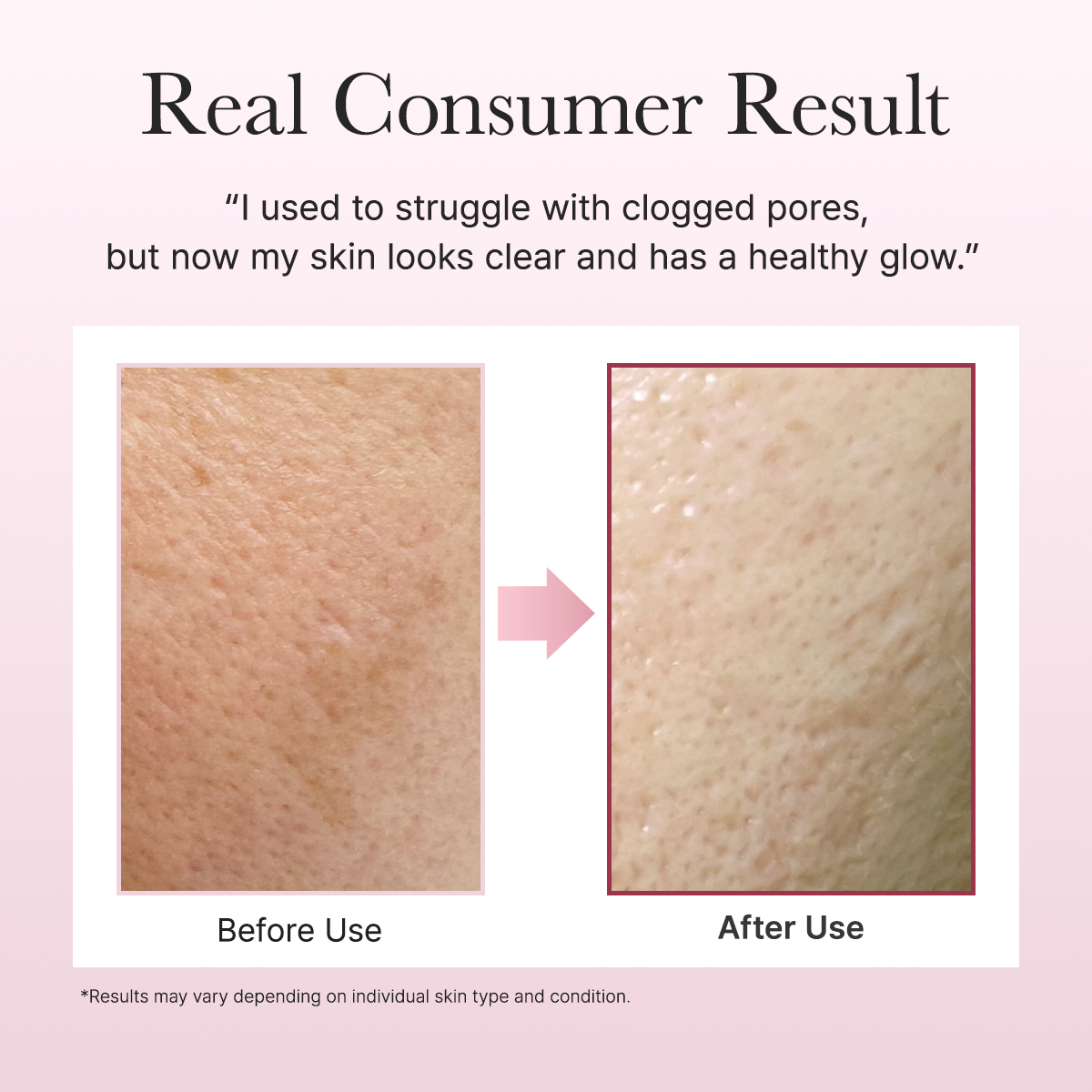 Arencia Fresh Rosehip Rice Mochi Cleanser 120gr