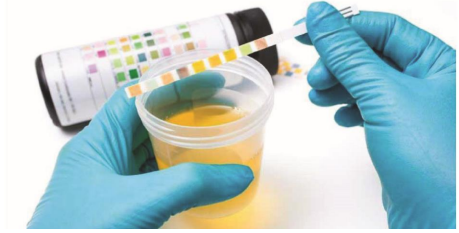 Urinálise Microscópica