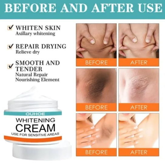 Pack Of 2 | Sensitive Area Whitening Cream For Private Parts, Underarms, Inner Thighs, And Dark Spot Lightening -30ml