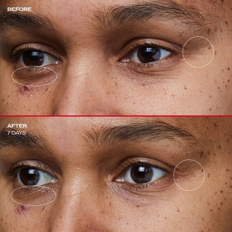 Benefiance Wrinkle Smoothing Eye Cream