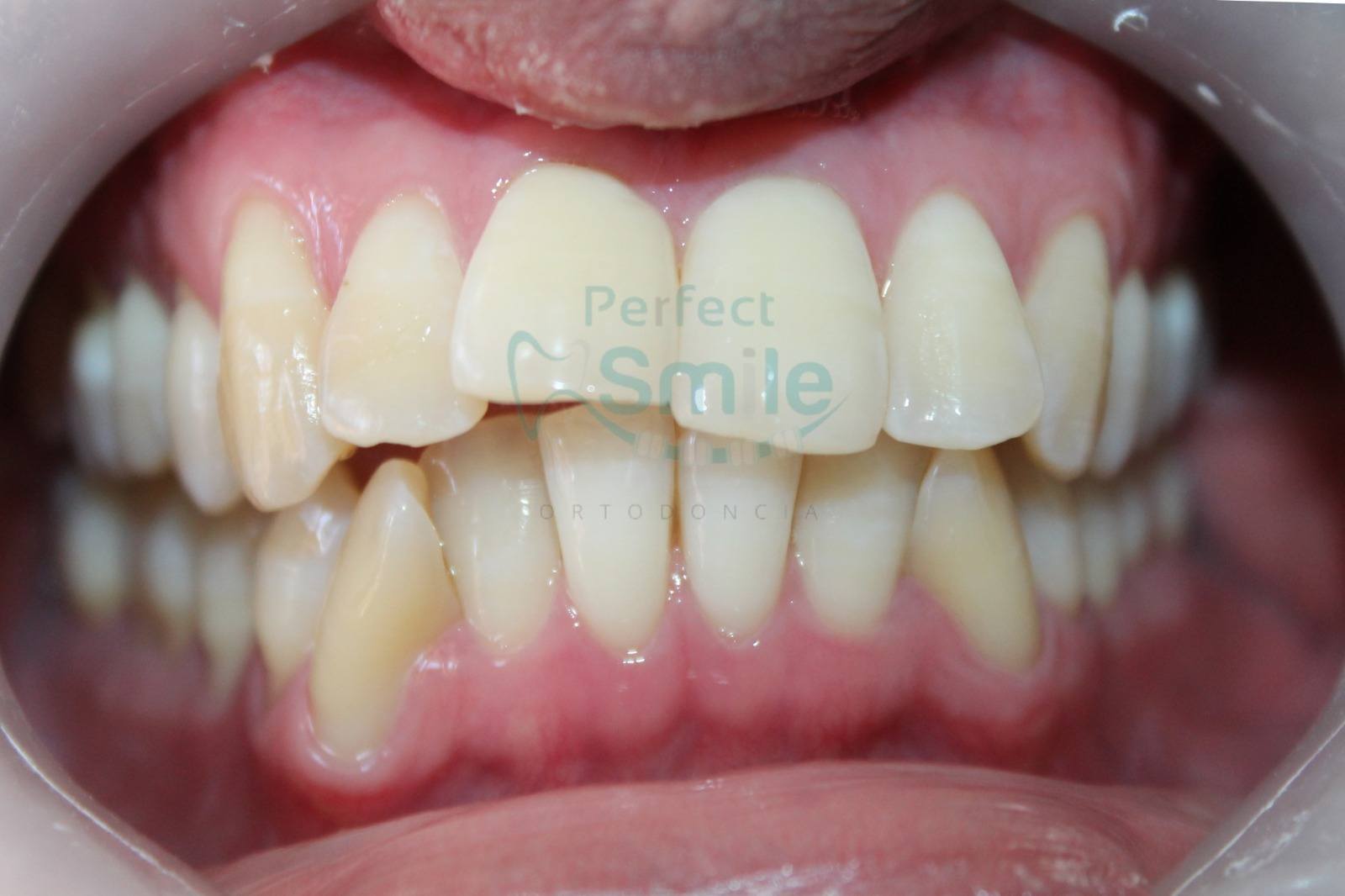 Perfect Smile Dr. Manuel Cortez 