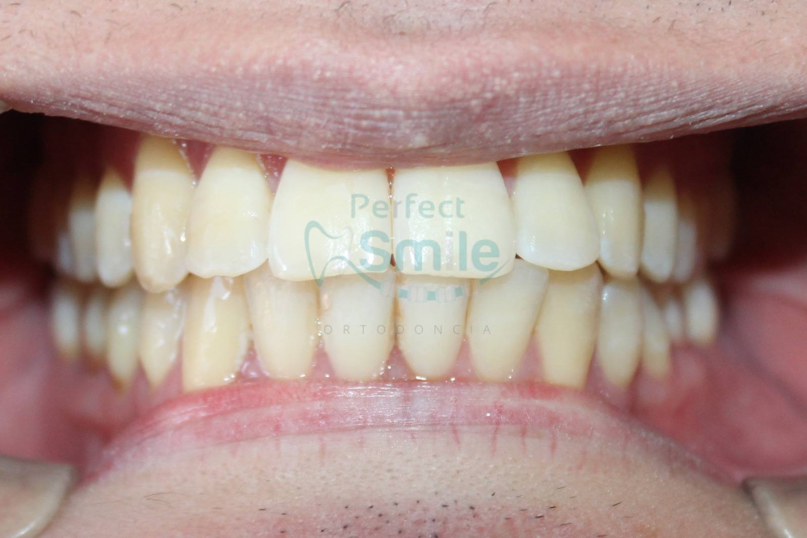 Perfect Smile Dr. Manuel Cortez 