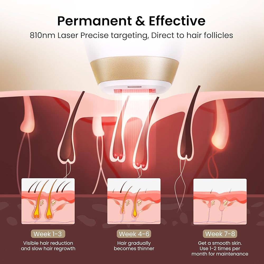 جهاز ديرما رايس بتقنية الدايود ليزر لانهاء نمو الشعر DermRays Diode Laser Hair Removal, 810nm