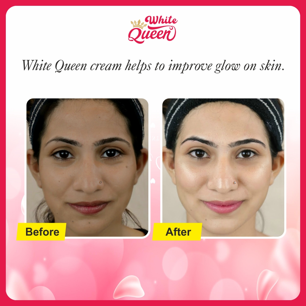 White Queen Skin Brightening & Whitening Cream (2pcs of 50gm)